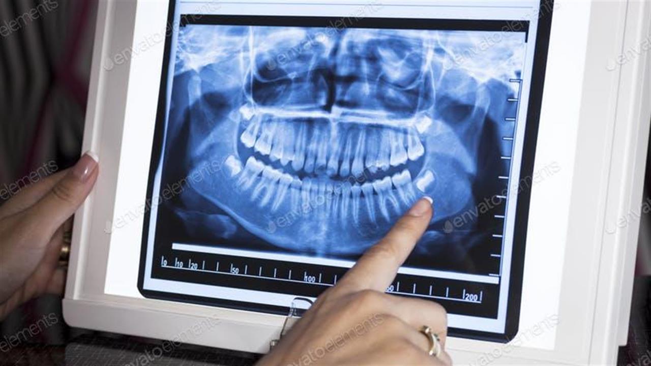 xray dental problems