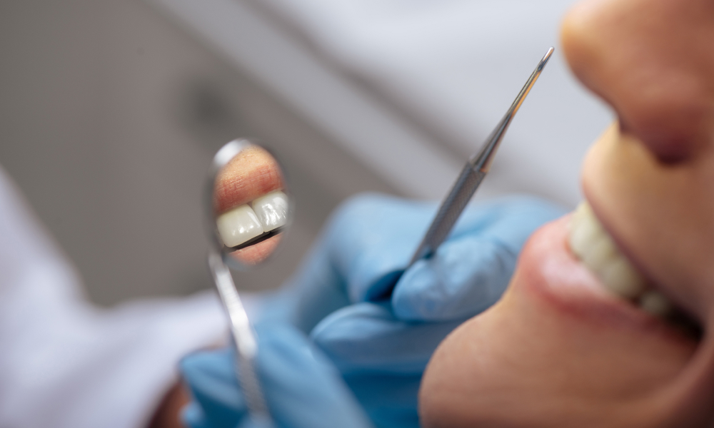 How-Often-Should-You-See-a-Dental-Hygienist